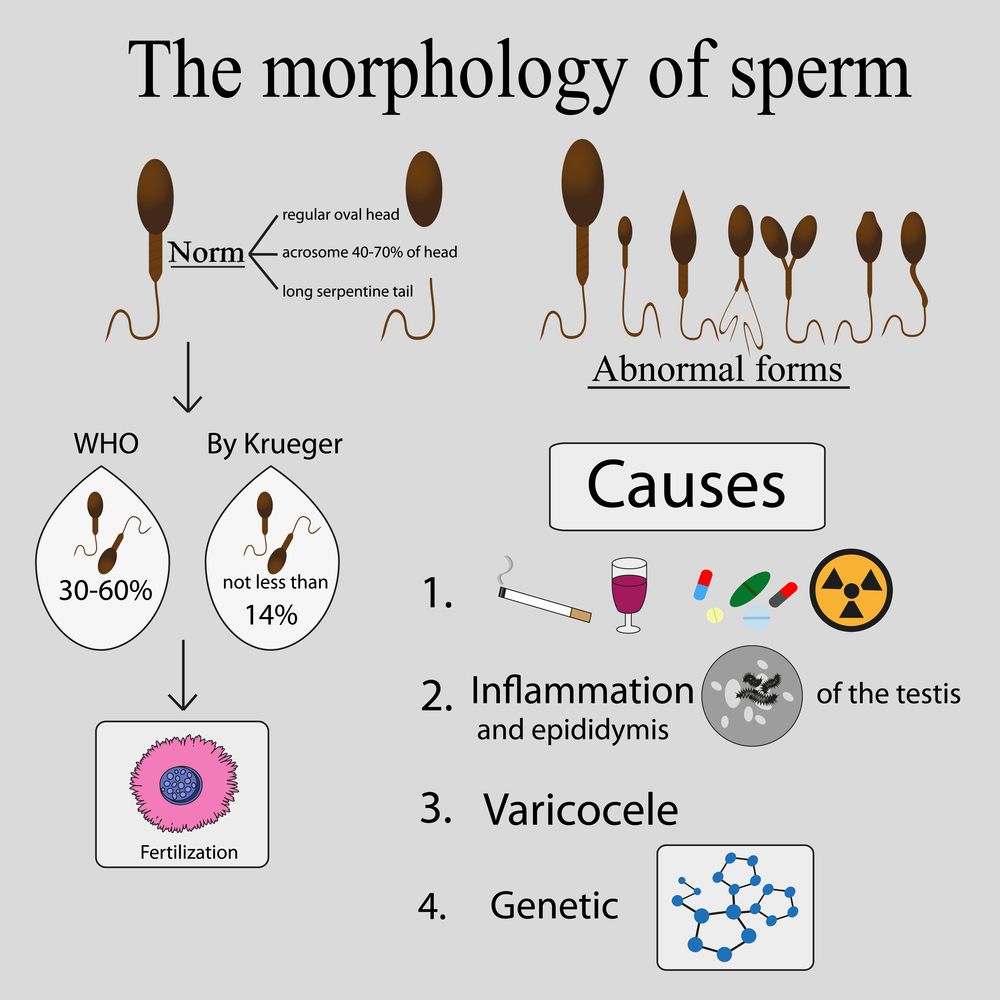 Морфология сперматозоидов по Крюгеру